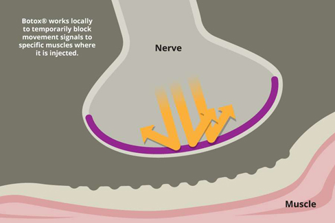 Nerve Signal
